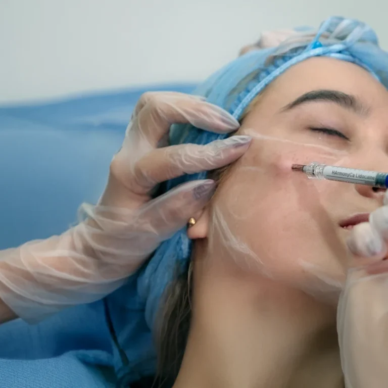 Botox+Harmonyca+Skinvive-33